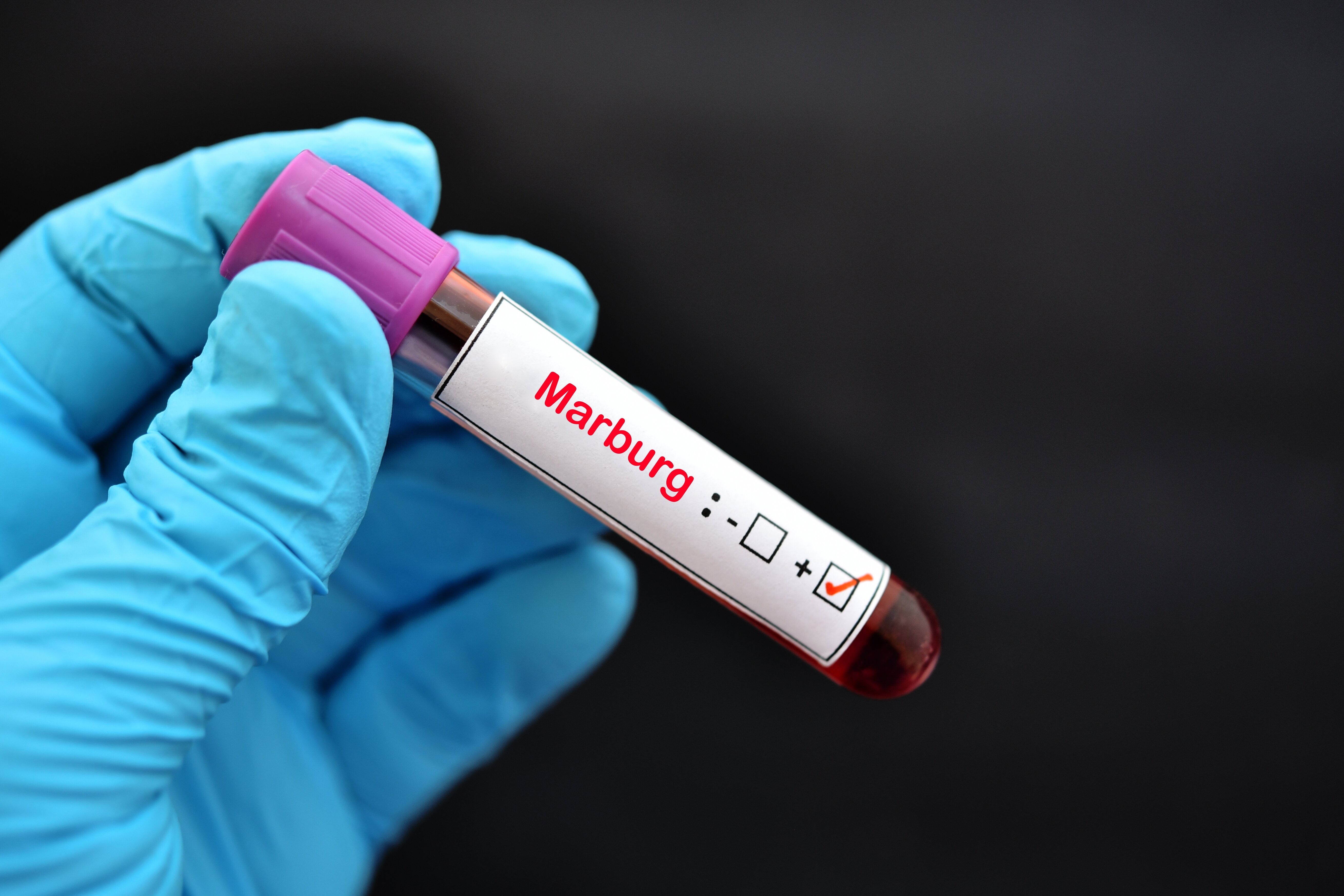 UAE's Ministry of Health and Prevention issues travel warnings following outbreak of Marburg virus 